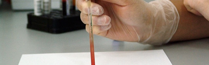 Haematology Haematology